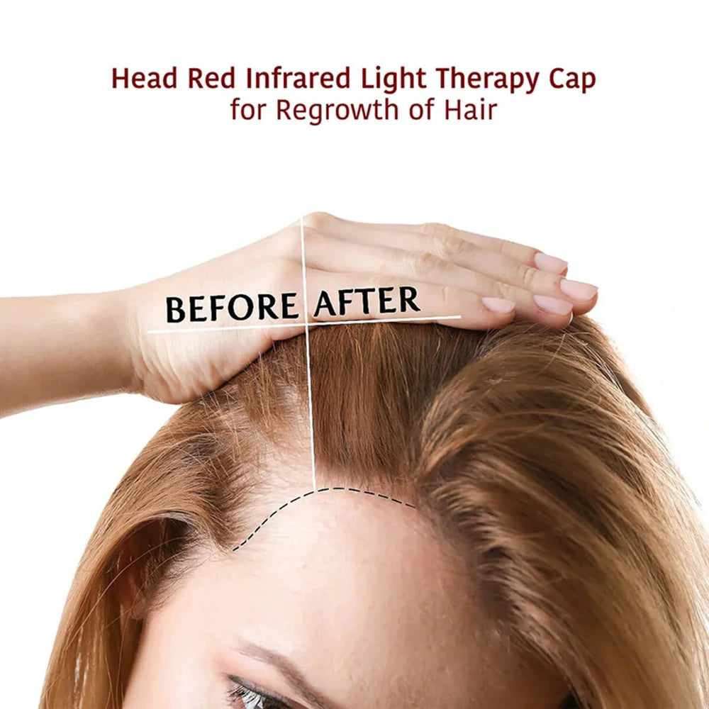 Kneadify Red Light Hair Growth Cap